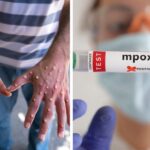 Germany To Donate 100,000 Mpox Vaccines To Africa