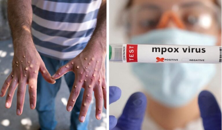 Germany To Donate 100,000 Mpox Vaccines To Africa