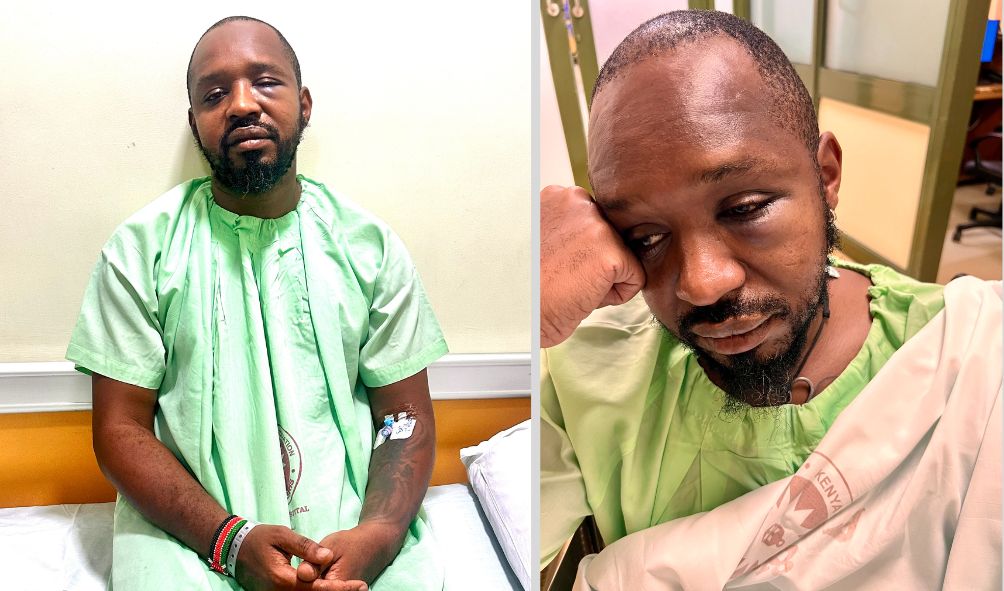 Activist Boniface Mwangi Says Police Officers Assaulted, Robbed Him