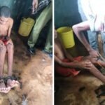 Police Rescue Kwale Man Imprisoned In Shackles By His Family